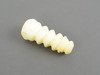 ES#2802532 - 31336778544 - Foam Bump Stop for Strut - Rein - BMW