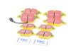 ES#2877016 - dp41517rKT - Brake Pad Kit - Front & Rear - Complete set of brake pads to service your vehicle - EBC - Volkswagen